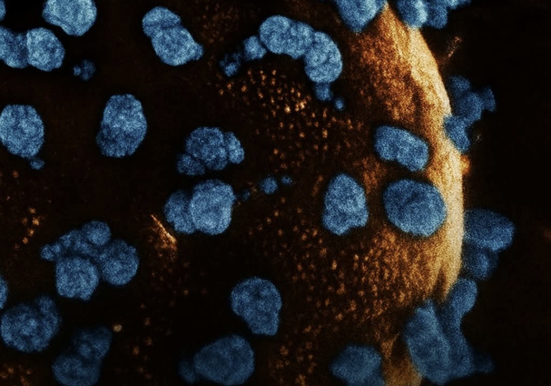 Ilmuwan Tiongkok Capai Terobosan Medis Dunia! Berhasil Membalikkan Diabetes Tipe 1 dengan Terapi Sel Punca