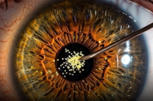 Terobosan Penelitian! Suntikan Partikel Emas Bisa Pulihkan Penglihatan Tanpa Operasi