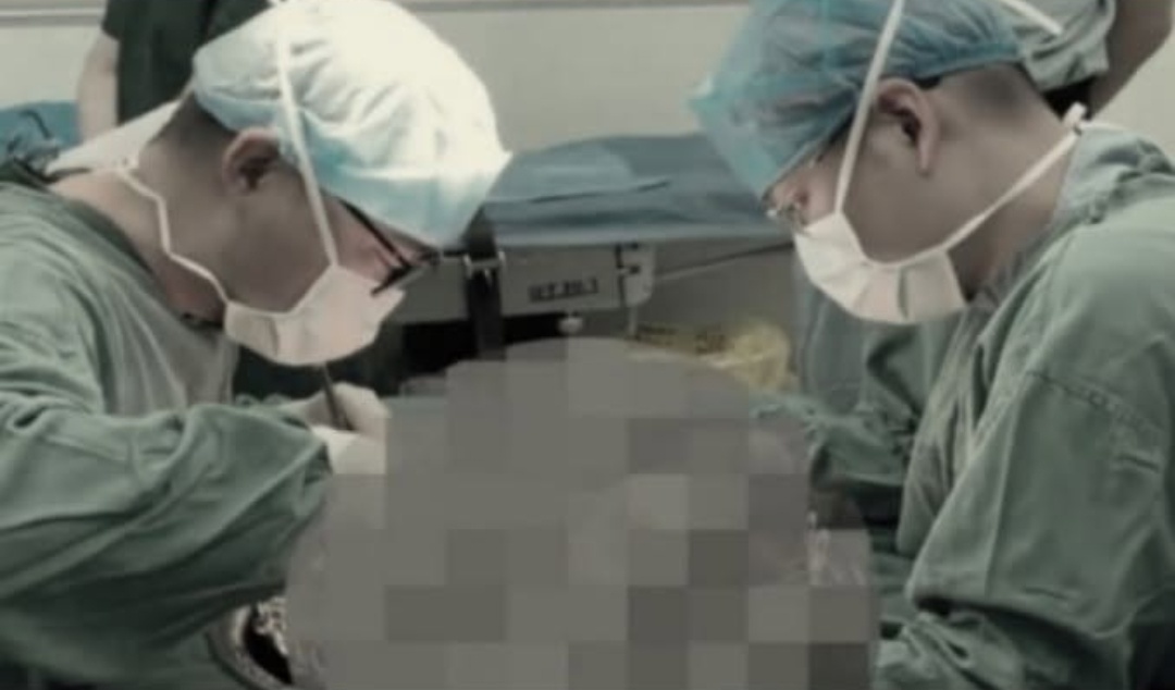 31 Transplantasi Organ dalam Sehari di Kunming, Publik Tiongkok Curiga, Dari Mana Asal Organ-Organ Itu?